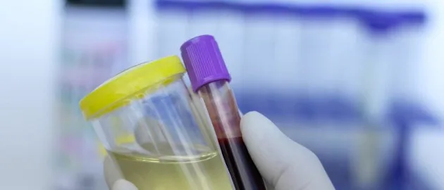 beyond testing postive