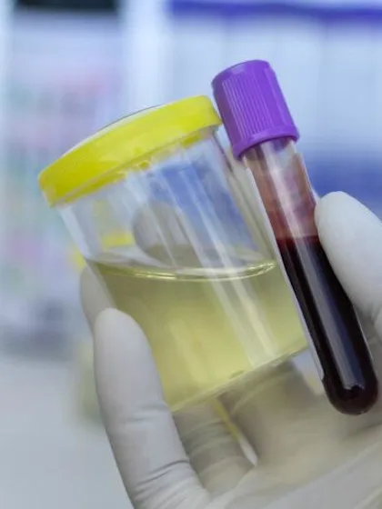 Beyond testing positive